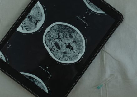 RECAP: Neurology News Network - Week of July 25th | NeurologyLive