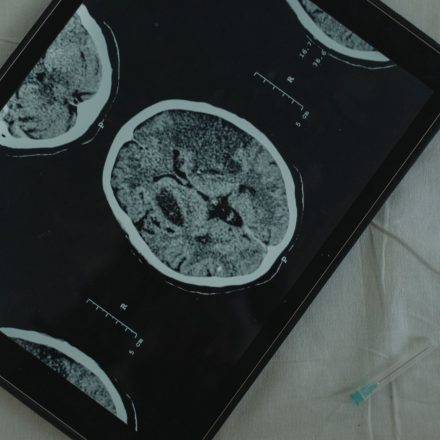 RECAP: Neurology News Network - Week of July 25th | NeurologyLive