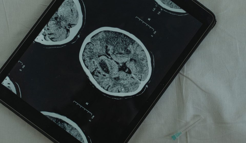 RECAP: Neurology News Network - Week of July 25th | NeurologyLive