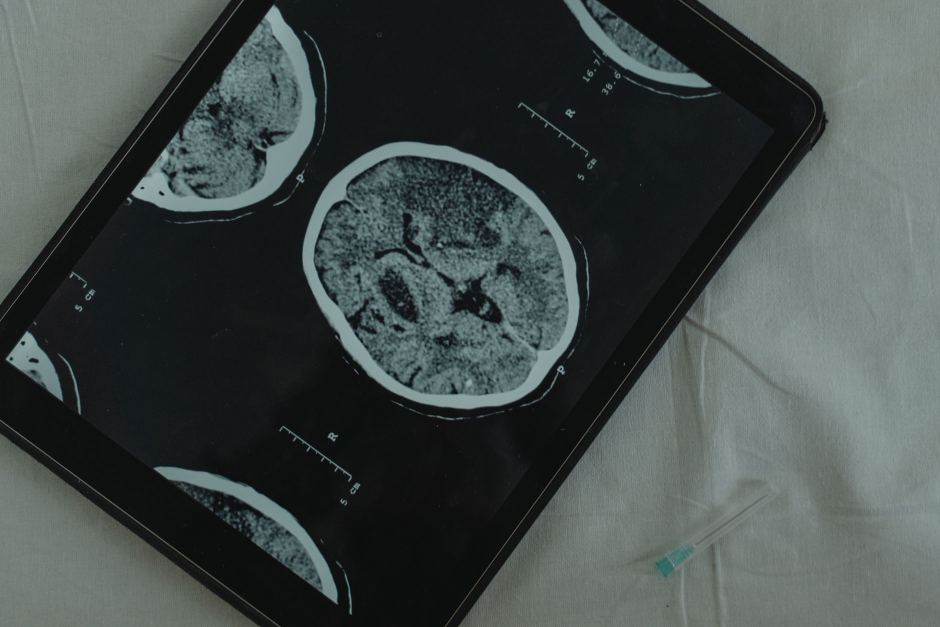 RECAP: Neurology News Network – Week of July 25th | NeurologyLive