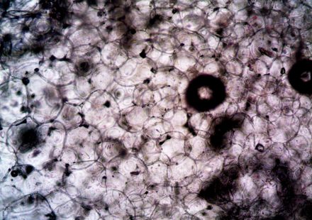 CBD Reduces Brain Inflammation, Partially Restores Immune-Cell Function in Study of Gulf ...