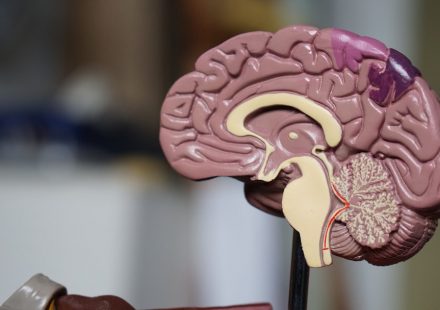 THC-CBD Combination Reduces Agitation in Advanced Dementia