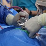 Cannabis, Nicotine, and Spine Fusion Outcomes | cannabis nicotine spine fusion outcomes