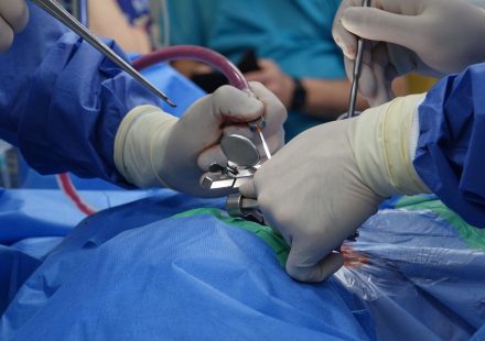 Cannabis, Nicotine, and Spine Fusion Outcomes | cannabis nicotine spine fusion outcomes