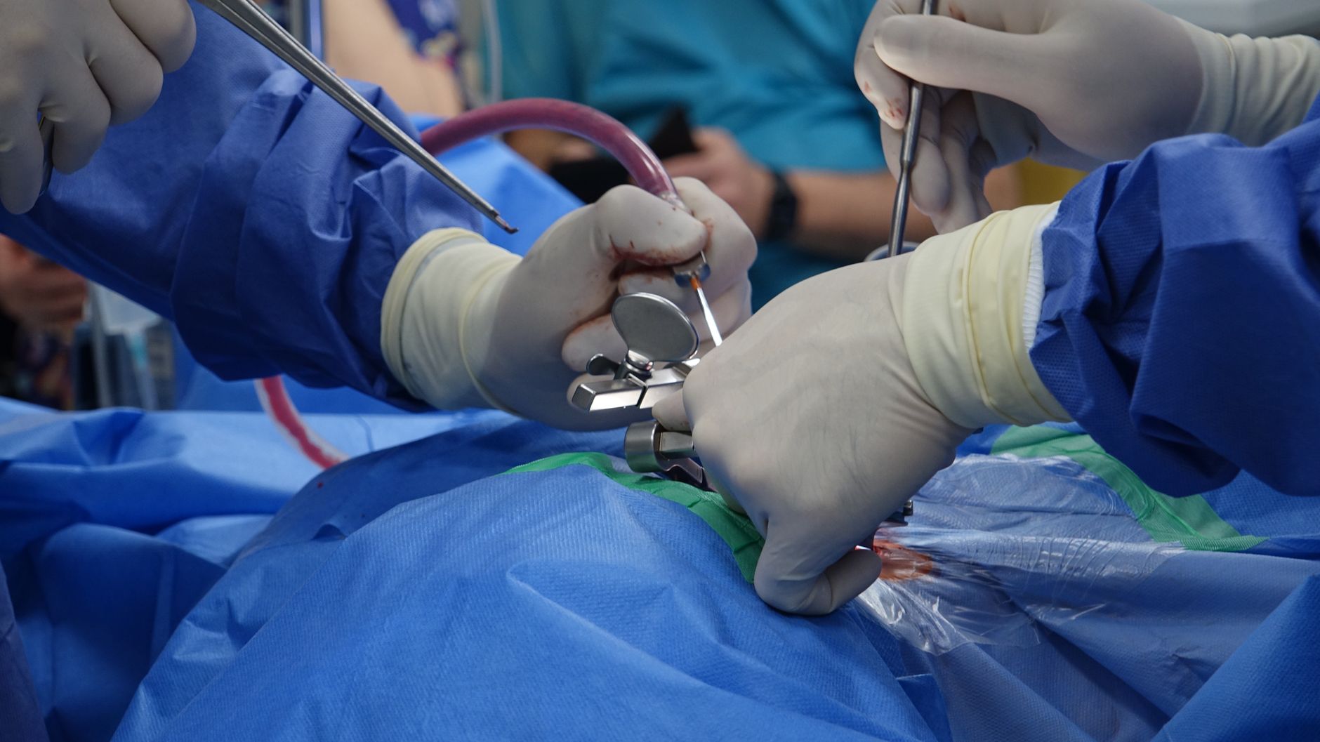 CED Clinic: Personalized Cannabis Medicine 302 Cannabis and Nicotine Before Spine Fusion: Insights from a Large Cohort Study