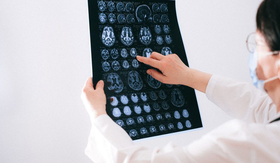 CBD Anxiety Neuroimaging Evidence Review | CBD anxiety neuroimaging evidence