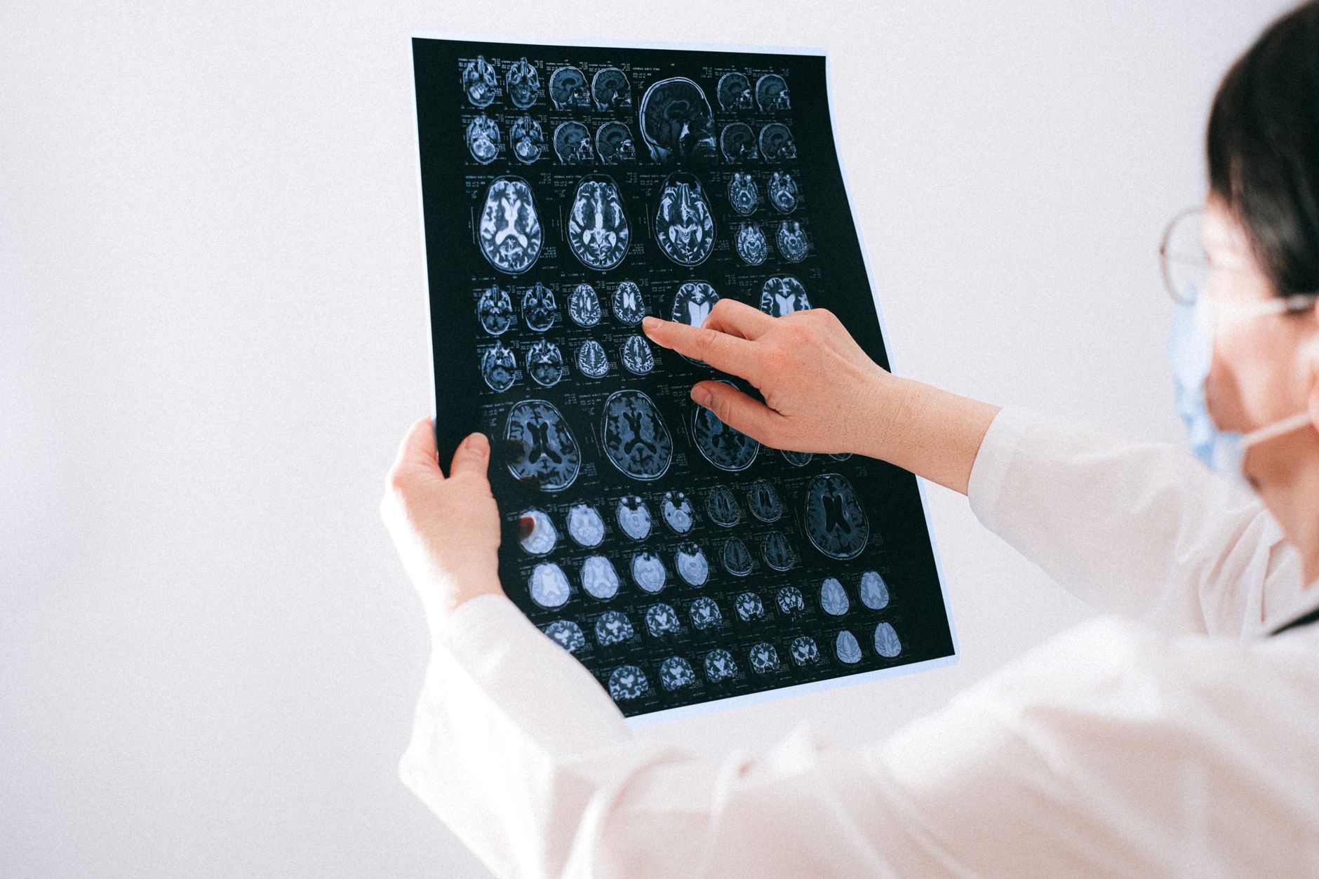 CBD and Anxiety: What a New Brain-Imaging Review Actually Shows
