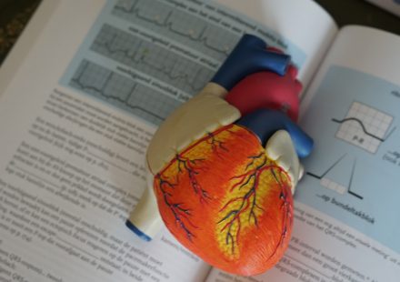 Cannabis and Coronary Thrombosis Case Report | cannabis coronary thrombosis case report