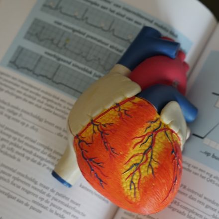 Cannabis and Coronary Thrombosis Case Report | cannabis coronary thrombosis case report