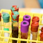 Fibromyalgia Cannabis Trial Finds No Change in Endocannabinoid Blood Markers | cannabis fibromyalgia endocannabinoid biomarker