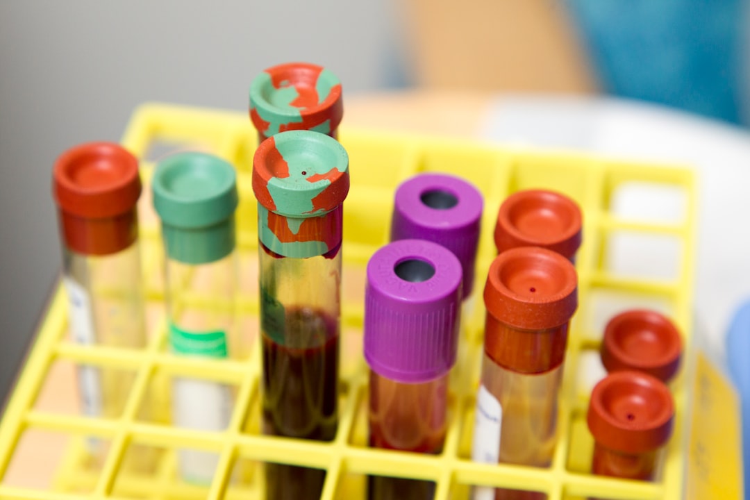 CED Clinic: Personalized Cannabis Medicine 297 Medicinal Cannabis and Fibromyalgia: Endocannabinoid Biomarkers Trial