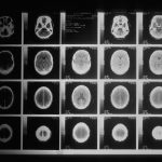 THC PTSD Cognitive Reappraisal Trial | THC PTSD cognitive reappraisal