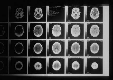 THC PTSD Cognitive Reappraisal Trial | THC PTSD cognitive reappraisal